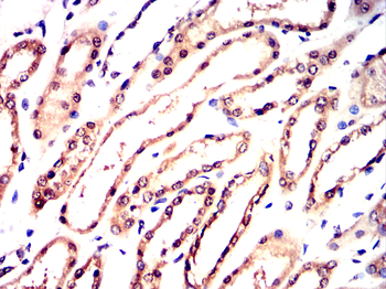SUV39H1 Antibody