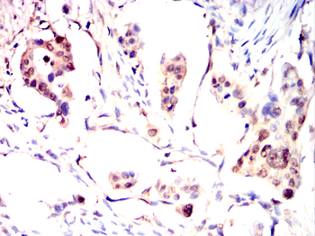 SUV39H1 Antibody