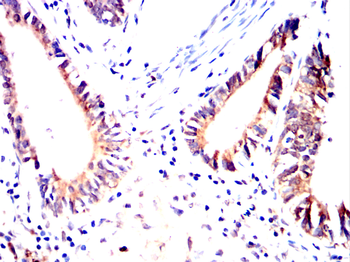 GMFG Antibody