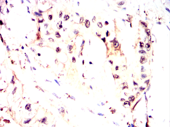 PRDM10 Antibody