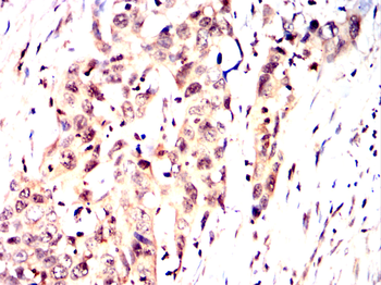 PRDM10 Antibody