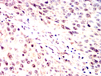 PRDM10 Antibody