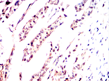 PRDM10 Antibody