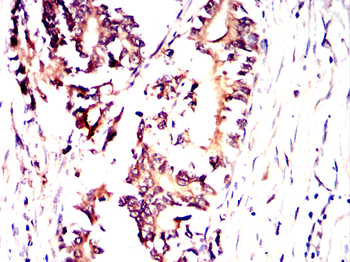 MAP4K3 Antibody