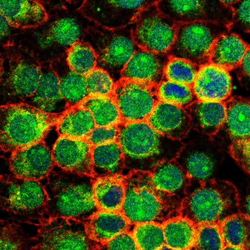 TOR1A Antibody