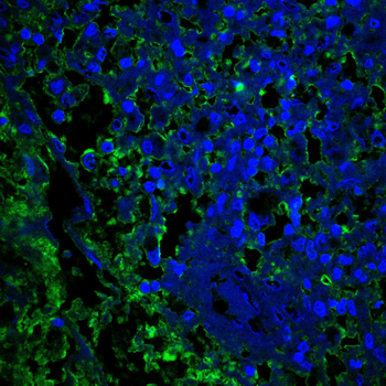 TOR1A Antibody