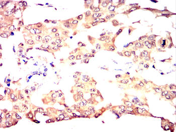 TOR1A Antibody