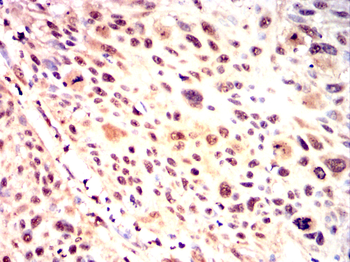 TOR1A Antibody