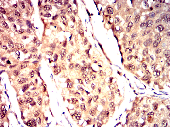 TOR1A Antibody
