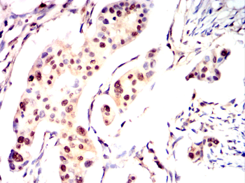 TOR1A Antibody