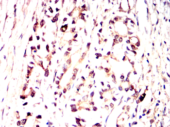 TOR1A Antibody