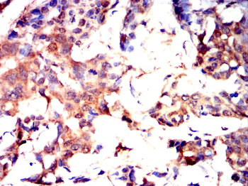 GSTA1 Antibody