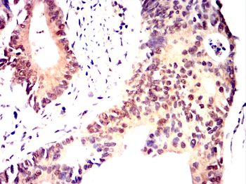 LGALS3 Antibody