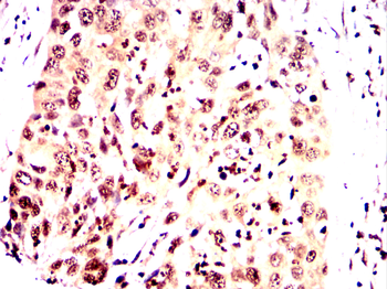 AHNAK Antibody