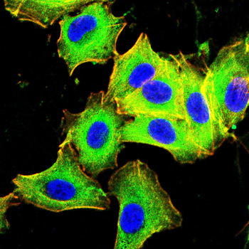 PRKAB1 Antibody