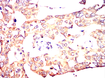 PRKAB1 Antibody