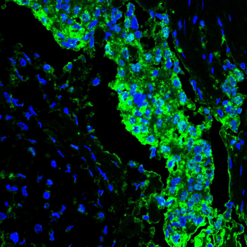 CNOT4 Antibody