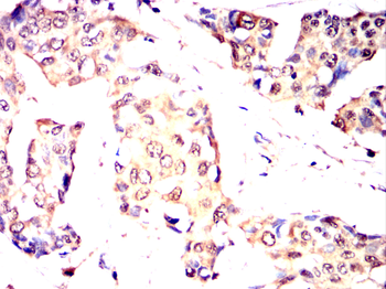ADAMTS4 Antibody