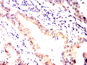 ADAMTS4 Antibody