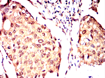 ADAMTS4 Antibody