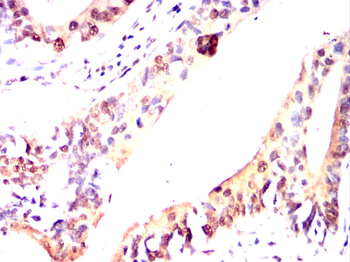 ADAMTS4 Antibody