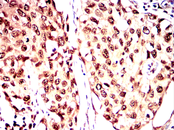 CDCA8 Antibody