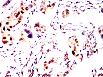 CDCA8 Antibody