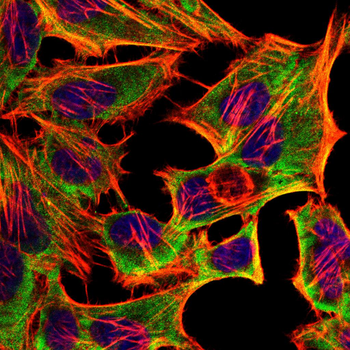 HNMT Antibody