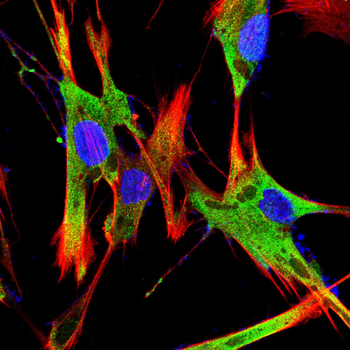 PGK1 Antibody