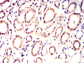 PACSIN2 Antibody