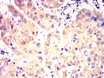 PACSIN2 Antibody