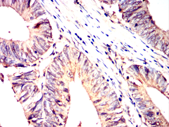 CRY2 Antibody