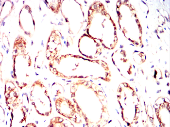 CRY2 Antibody