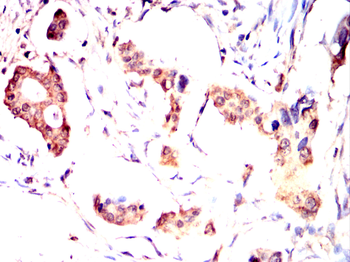 IKBKG Antibody