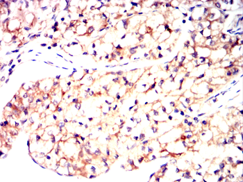 IKBKG Antibody