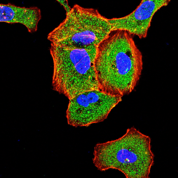 FN3K Antibody