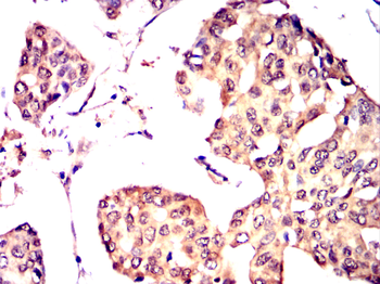 FN3K Antibody