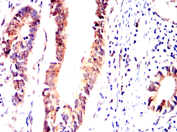 FN3K Antibody