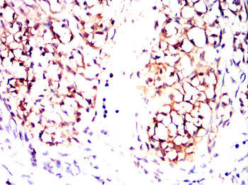 FN3K Antibody