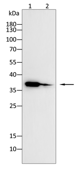 FN3K Antibody