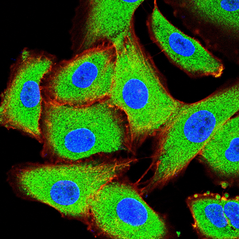 ACVR1B Antibody