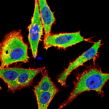 ARSA Antibody