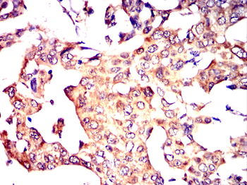 ARSA Antibody