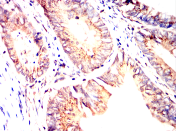 ARSA Antibody