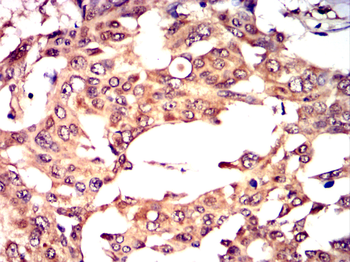DPYSL2 Antibody