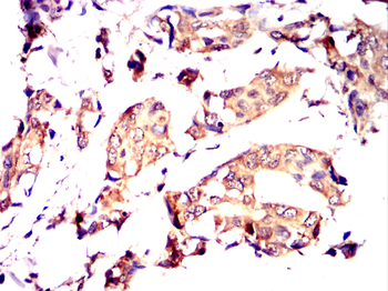 CHRM2 Antibody