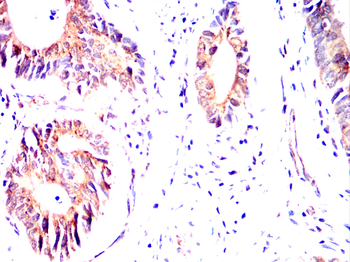 CHRM2 Antibody