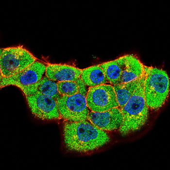 RAB29 Antibody