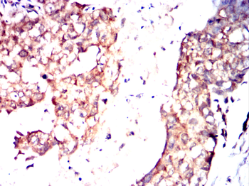 RAB29 Antibody