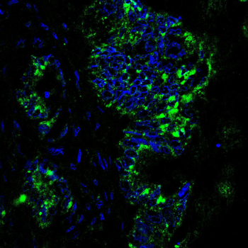 RAB29 Antibody